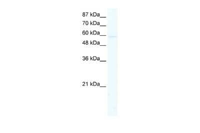 Western Blot: KCNK10 Antibody [NBP2-87662] - WB Suggested Anti-KCNK10 Antibody Titration: 2.5ug/ml. ELISA Titer: 1:62500. Positive Control: Jurkat cell lysate