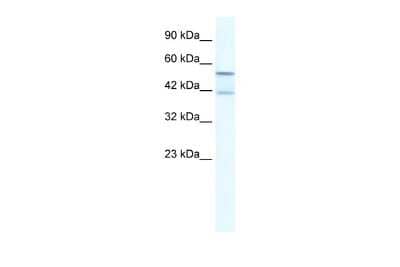 Western Blot KCNK10 Antibody