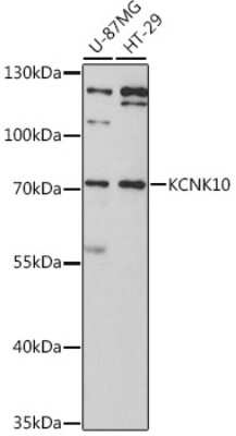 Western Blot: KCNK10 Antibody [NBP3-05006] - Analysis of extracts of various cell lines, using KCNK10 antibody at 1:3000 dilution. Secondary antibody: HRP Goat Anti-Rabbit IgG (H+L) at 1:10000 dilution. Lysates/proteins: 25ug per lane. Blocking buffer: 3% nonfat dry milk in TBST. Detection: ECL Basic Kit