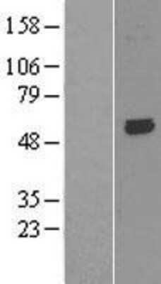 Western Blot: KCNK10 Overexpression Lysate (Adult Normal) [NBL1-12177] Left-Empty vector transfected control cell lysate (HEK293 cell lysate); Right -Over-expression Lysate for KCNK10.