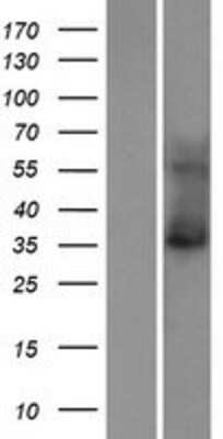 Western Blot: KCNK15 Overexpression Lysate (Adult Normal) [NBP2-06440] Left-Empty vector transfected control cell lysate (HEK293 cell lysate); Right -Over-expression Lysate for KCNK15.