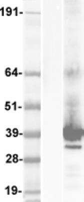 Western Blot KCNK17 Overexpression Lysate