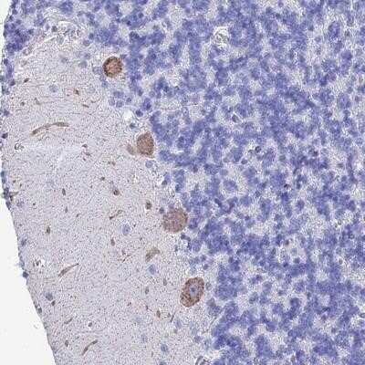 Immunohistochemistry-Paraffin: KCNK18 Antibody [NBP1-81570] - Staining of human cerebellum shows moderate cytoplasmic positivity in Purkinje cells.
