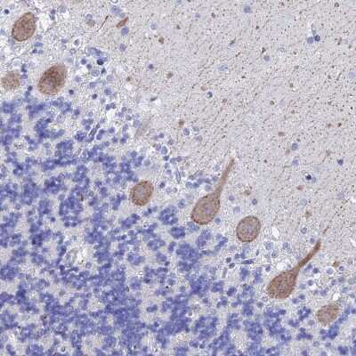 Immunohistochemistry-Paraffin: KCNK18 Antibody [NBP1-81570] - Staining of human cerebellum shows moderate membranous and cytoplasmic positivity in Purkinje cells.