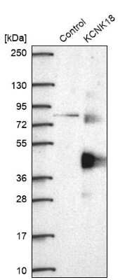 Western Blot: KCNK18 Antibody [NBP1-81570] - Analysis in control (vector only transfected HEK293T lysate) and KCNK18 over-expression lysate (Co-expressed with a C-terminal myc-DDK tag (3.1 kDa) in mammalian HEK293T cells).