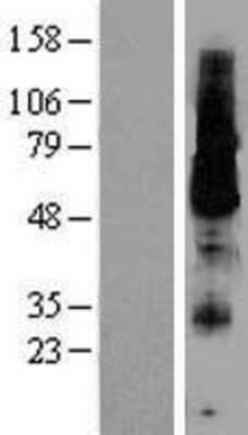 Western Blot: KCNK18 Overexpression Lysate (Adult Normal) [NBL1-12181] Left-Empty vector transfected control cell lysate (HEK293 cell lysate); Right -Over-expression Lysate for KCNK18.