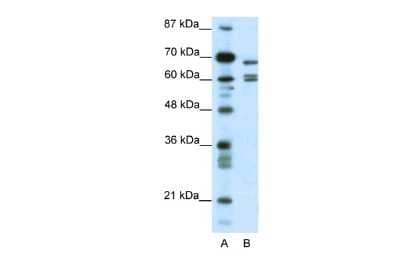 Western Blot: KCNK5 Antibody [NBP2-85135] - WB Suggested Anti-KCNK5 Antibody Titration: 0.2-1 ug/ml. ELISA Titer: 1:62500. Positive Control: HepG2 cell lysate