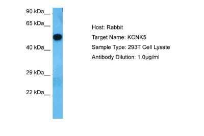 Western Blot: KCNK5 Antibody [NBP2-85136] - Host: Rabbit. Target Name: KCNK5. Sample Tissue: Human 293T Whole Cell. Antibody Dilution: 1.0ug/ml