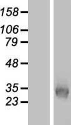 Western Blot: KCNK7 Overexpression Lysate (Adult Normal) [NBP2-05886] Left-Empty vector transfected control cell lysate (HEK293 cell lysate); Right -Over-expression Lysate for KCNK7.