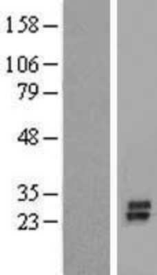 Western Blot: KCNK7 Overexpression Lysate (Adult Normal) [NBP2-05887] Left-Empty vector transfected control cell lysate (HEK293 cell lysate); Right -Over-expression Lysate for KCNK7.