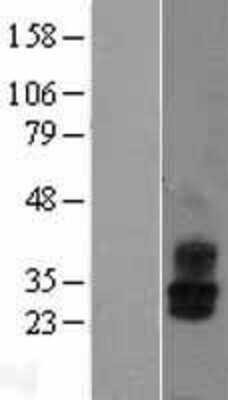 Western Blot: KCNMB2 Overexpression Lysate (Adult Normal) [NBL1-12191] Left-Empty vector transfected control cell lysate (HEK293 cell lysate); Right -Over-expression Lysate for KCNMB2.
