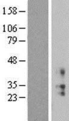 Western Blot: KCNMB2 Overexpression Lysate (Adult Normal) [NBL1-12192] Left-Empty vector transfected control cell lysate (HEK293 cell lysate); Right -Over-expression Lysate for KCNMB2.