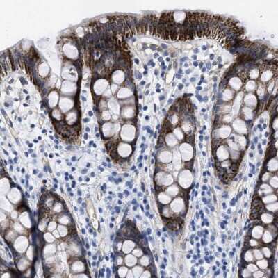 Immunohistochemistry-Paraffin KCNMB3 Antibody