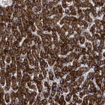 Immunohistochemistry-Paraffin: KCNMB3 Antibody [NBP1-83066] - Staining of human liver shows strong cytoplasmic positivity in hepatocytes.