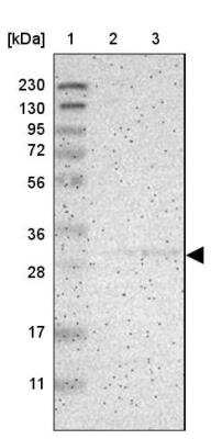 Western Blot: KCNMB3 Antibody [NBP1-83066] - Lane 1: Marker  [kDa] 230, 130, 95, 72, 56, 36, 28, 17, 11.  Lane 2: Human cell line RT-4.  Lane 3: Human cell line U-251MG sp