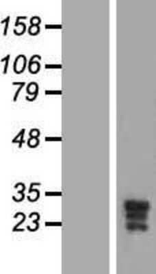 Western Blot: KCNMB3 Overexpression Lysate (Adult Normal) [NBP2-05181] Left-Empty vector transfected control cell lysate (HEK293 cell lysate); Right -Over-expression Lysate for KCNMB3.