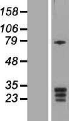 Western Blot: KCNMB3 Overexpression Lysate (Adult Normal) [NBP2-05182] Left-Empty vector transfected control cell lysate (HEK293 cell lysate); Right -Over-expression Lysate for KCNMB3.