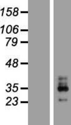 Western Blot: KCNMB3 Overexpression Lysate (Adult Normal) [NBP2-07344] Left-Empty vector transfected control cell lysate (HEK293 cell lysate); Right -Over-expression Lysate for KCNMB3.