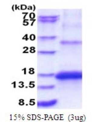 SDS-Page: KCNMB3 Recombinant Protein [NBP2-51813] - 15% SDS Page (3 ug)