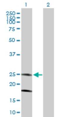 Western Blot KCNMB4 Antibody - Azide and BSA Free