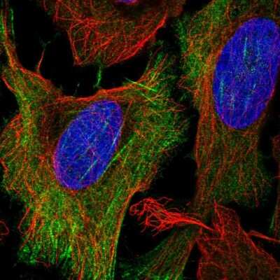 Immunocytochemistry/Immunofluorescence: KCNN1 Antibody [NBP2-57340] - Staining of human cell line U-2 OS shows localization to cytosol & actin filaments.