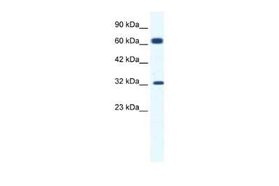 Western Blot: KCNN1 Antibody [NBP2-83105] - WB Suggested Anti-KCNN1 Antibody Titration: 1.25ug/ml. ELISA Titer: 1:312500. Positive Control: Jurkat cell lysate