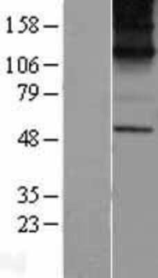 Western Blot: KCNN1 Overexpression Lysate (Adult Normal) [NBP2-04221] Left-Empty vector transfected control cell lysate (HEK293 cell lysate); Right -Over-expression Lysate for KCNN1.