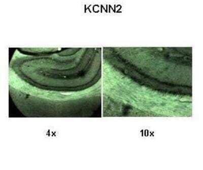 Immunohistochemistry: KCNN2 Antibody [NBP2-84111] - Lanes: Rat brain section. Primary Antibody Dilution: 1:500. Secondary Antibody: Anti-rabbit-biotin, streptavidin-diaminobenzidine. Secondary Antibody Dilution: 1:500. Gene Name: KCNN2. Submitted by: Dr. Amiel Rosenkranz, Rosalind Franklin University. 