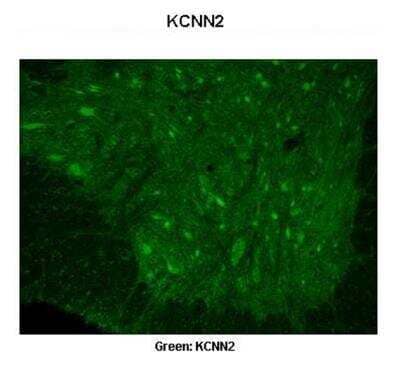 Immunohistochemistry: KCNN2 Antibody [NBP2-84111] - Sample Type: Rhesus macaque spinal cord. Primary Antibody Dilution: 1:300. Secondary Antibody: Donkey anti Rabbit 488. Secondary Antibody Dilution: 1:500. Color/Signal Descriptions: Green: KCNN2. Gene Name: KCNN2. Submitted by: Timur Mavlyutov, Ph. D., Department of Pharmacology, University of Wisconsin Medical School 