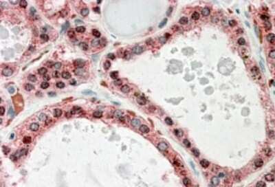 Immunohistochemistry-Paraffin: KCNN2 Antibody [NBP1-46119] - Staining of paraffin embedded human thyroid gland. Antibody at 3.8 ug/mL. Steamed antigen retrieval with citrate buffer pH 6, AP-staining.