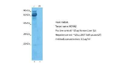 Western Blot: KCNN2 Antibody [NBP2-84111] - Host: Rabbit. Target: KCNN2. Positive control (+): Human liver (LI). Negative control (-): 293T (2T). Antibody concentration: 0.5ug/ml