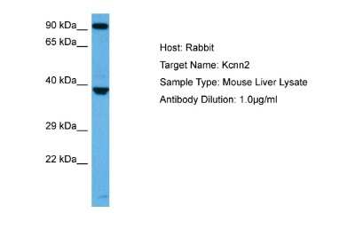 Western Blot: KCNN2 Antibody [NBP2-84113] - Host: Rabbit. Target Name: KCNN2. Sample Tissue: Mouse Liver lysates. Antibody Dilution: 1ug/ml