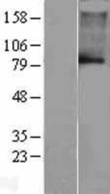 Western Blot: KCNN3 Overexpression Lysate (Adult Normal) [NBL1-12195] Left-Empty vector transfected control cell lysate (HEK293 cell lysate); Right -Over-expression Lysate for KCNN3.