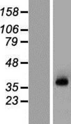 Western Blot: KCNN3 Overexpression Lysate (Adult Normal) [NBP2-05209] Left-Empty vector transfected control cell lysate (HEK293 cell lysate); Right -Over-expression Lysate for KCNN3.