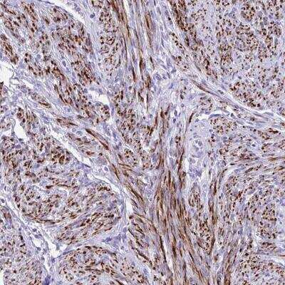 Immunohistochemistry-Paraffin: KCNN4 Antibody [NBP2-32484] - Staining of human smooth muscle shows strong cytoplasmic positivity in smooth muscle cells.