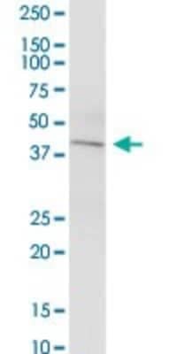 Western Blot KCNN4 Antibody