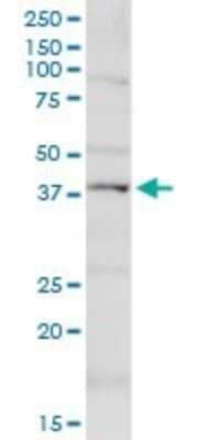 Western Blot KCNN4 Antibody