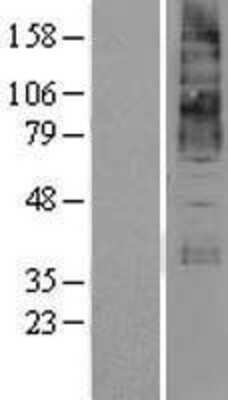 Western Blot KCNN4 Overexpression Lysate