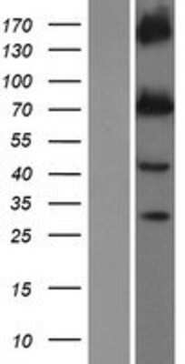 Western Blot: KCNQ1 Overexpression Lysate (Adult Normal) [NBP2-09069] Left-Empty vector transfected control cell lysate (HEK293 cell lysate); Right -Over-expression Lysate for KCNQ1.