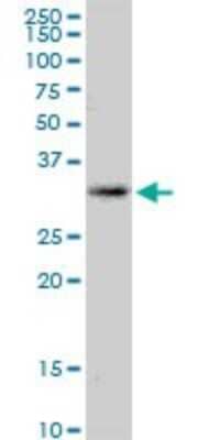 Western Blot KCNRG Antibody