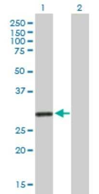 Western Blot KCNRG Antibody