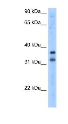 Western Blot: KCNRG Antibody [NBP1-80108] - Transfected 293T cell lysate, concentration 2.5 ug/ml.