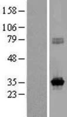 Western Blot: KCNRG Overexpression Lysate (Adult Normal) [NBP2-10099] Left-Empty vector transfected control cell lysate (HEK293 cell lysate); Right -Over-expression Lysate for KCNRG.