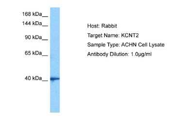 Western Blot: KCNT2 Antibody [NBP2-85138] - Host: Rabbit. Target Name: KCNT2. Sample Tissue: Human ACHN Whole Cell lysates. Antibody Dilution: 1ug/ml