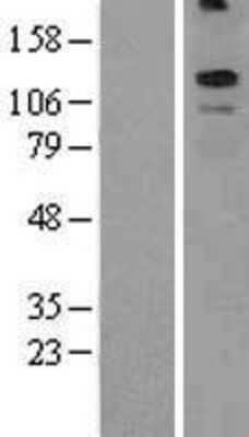 Western Blot: KCNT2 Overexpression Lysate (Adult Normal) [NBL1-12205] Left-Empty vector transfected control cell lysate (HEK293 cell lysate); Right -Over-expression Lysate for KCNT2.