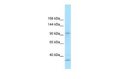 Western Blot: KCP Antibody [NBP1-98275] - Reccomended Titration: 1.0 ug/ml Positive Control: U937 Whole Cell