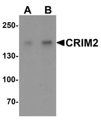 Western Blot: KCP Antibody [NBP2-81728] - Western blot analysis of KCP in Jurkat cell lysate with KCP antibody at (A) 1 and (B) 2 ug/mL.