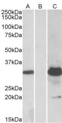 Western Blot: KCTD11 Antibody [NBP1-72049] HEK293 lysate (10ug protein in RIPA buffer) overexpressing Human KCTD11 with DYKDDDDK tag probed with (1.0ug/ml) in Lane A and probed with anti-DYKDDDDK Tag (1/5000) in lane C. Mock-transfected HEK293 probed with (1mg/ml) in Lane B. Primary incubations we