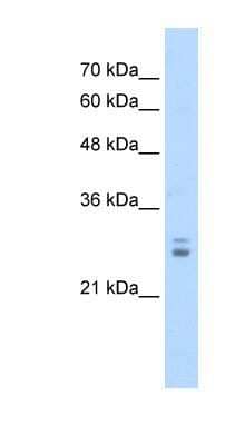 Western Blot: KCTD11 Antibody [NBP1-80109] - Jurkat cell lysate, concentration 1.25ug/ml.