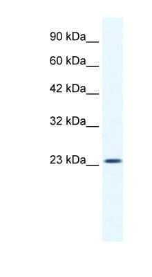 Western Blot: KCTD11 Antibody [NBP1-80211] - HepG2 cell lysate, concentration 1.25ug/ml.